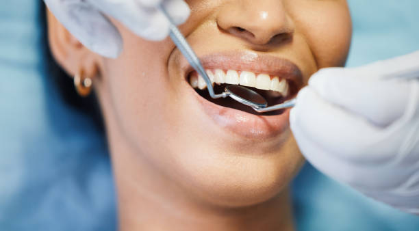 Best Teeth Whitening  in Bangor Base, WA