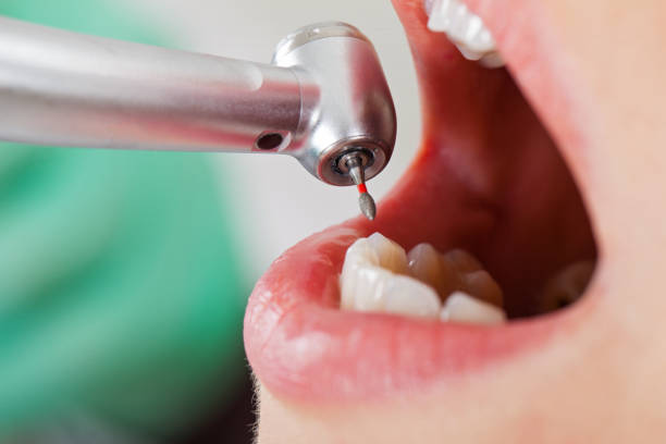 Best Same-Day Dentist Appointment  in Bangor Base, WA